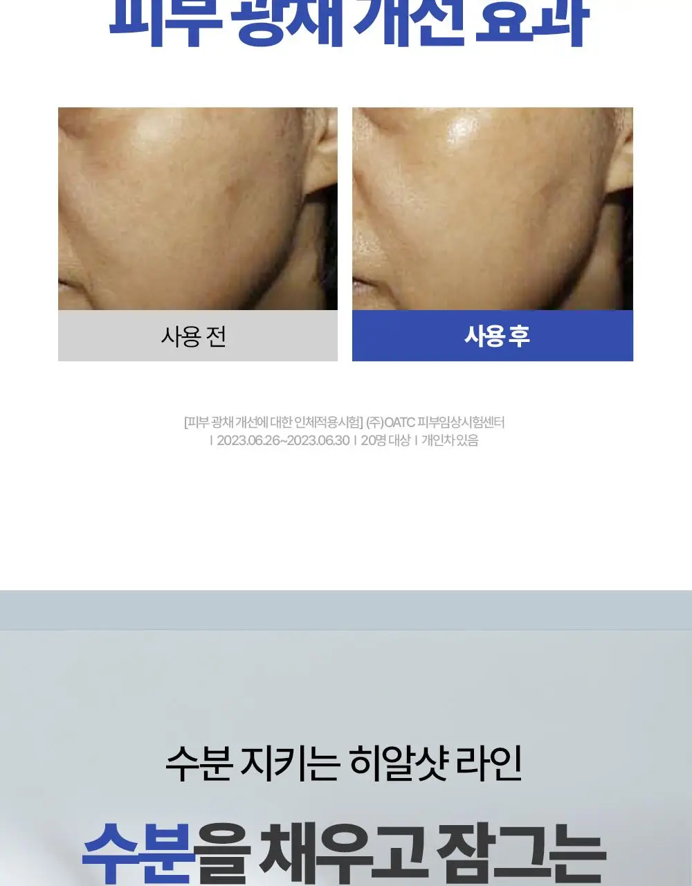 [쾌속수분/온라인 단독]더마토리 히알샷 베리어 앰플 비5 100ml 대용량 기획(100ml+10ml) 상세페이지 27